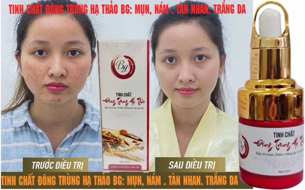 CÔNG TY TNHH THƯƠNG MẠI VÀ XUẤT NHẬP KHẨU BEAUTIFUL GIRL
